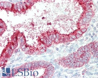 IHC-plus™ ECaC / TRPV5 Antibody (aa1-325)