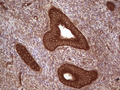 UBE2D2 / UBCH5B Antibody (clone OTI1D11)