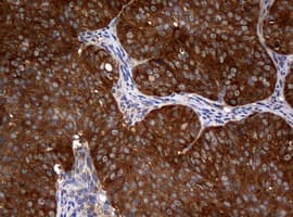 NME1 / NM23 Antibody (clone OTI1C12)