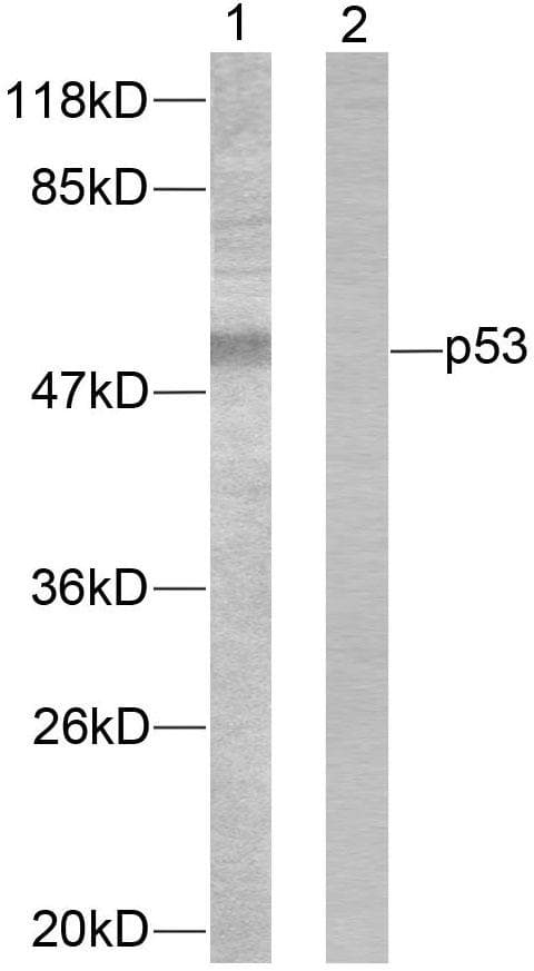 TP53 / p53 Antibody (p46)