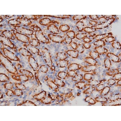 Polyclonal Rabbit anti-Human MAPT / Tau Antibody (phospho-Thr181, IHC, WB)