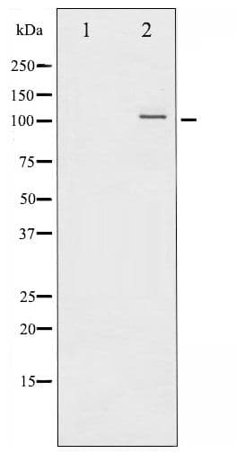 NFKB2 Antibody (phospho-Ser872)