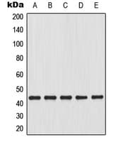 IHC-plus™ Polyclonal Rabbit anti-Human GJA1 / CX43 / Connexin 43 Antibody (C-Terminus, IHC, IF, WB)