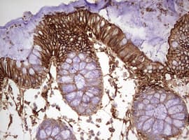 Monoclonal Mouse anti-Human KRT7 / CK7 / Cytokeratin 7 Antibody (clone OTI1B3, IHC, WB)