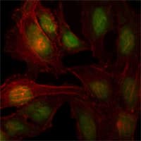 IHC-plus™ Monoclonal Mouse anti-Human ZBTB7B / HcKrox Antibody (clone 7C12, IHC, IF, WB)