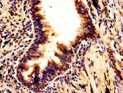 Polyclonal Rabbit anti-Human TIP49 / RUVBL1 Antibody