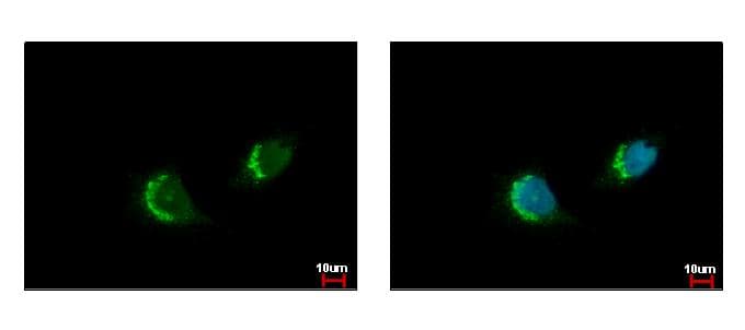 FAF2 / ETEA Antibody (aa383-445)