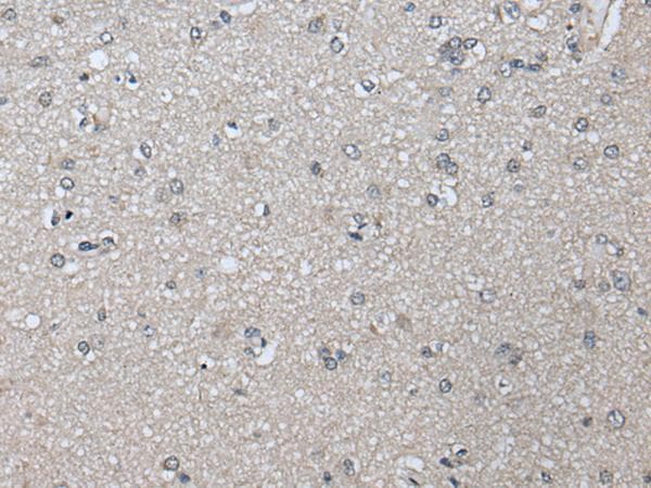 PRAME Antibody