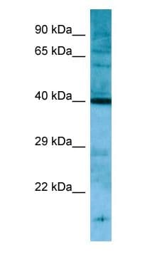 PNCK / CaMK1b Antibody (C-Terminus)