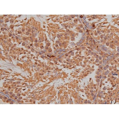 Polyclonal Rabbit anti-Human SP1 Antibody (phospho-Thr739, IHC, IF, WB)