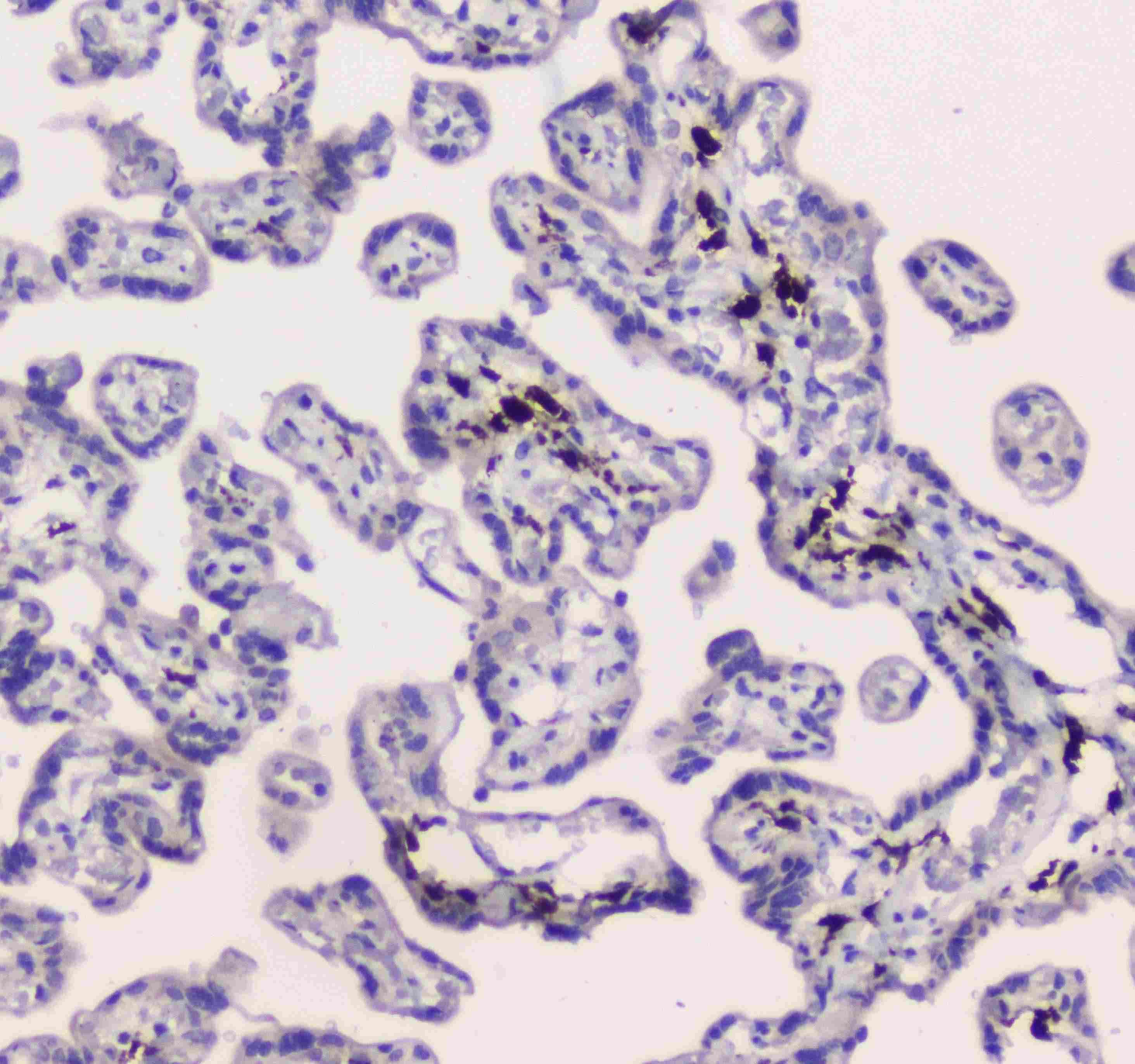 CD209 / DC-SIGN Antibody