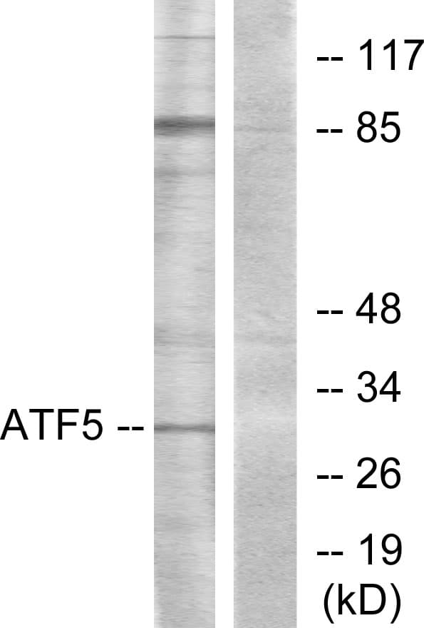 ATF5 Antibody (aa221-270)