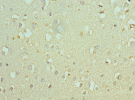 Polyclonal Rabbit anti-Human BAF53B / ACTL6B Antibody (aa1-280, IHC)
