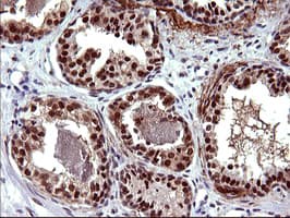 UPRT Antibody (clone OTI1A3)
