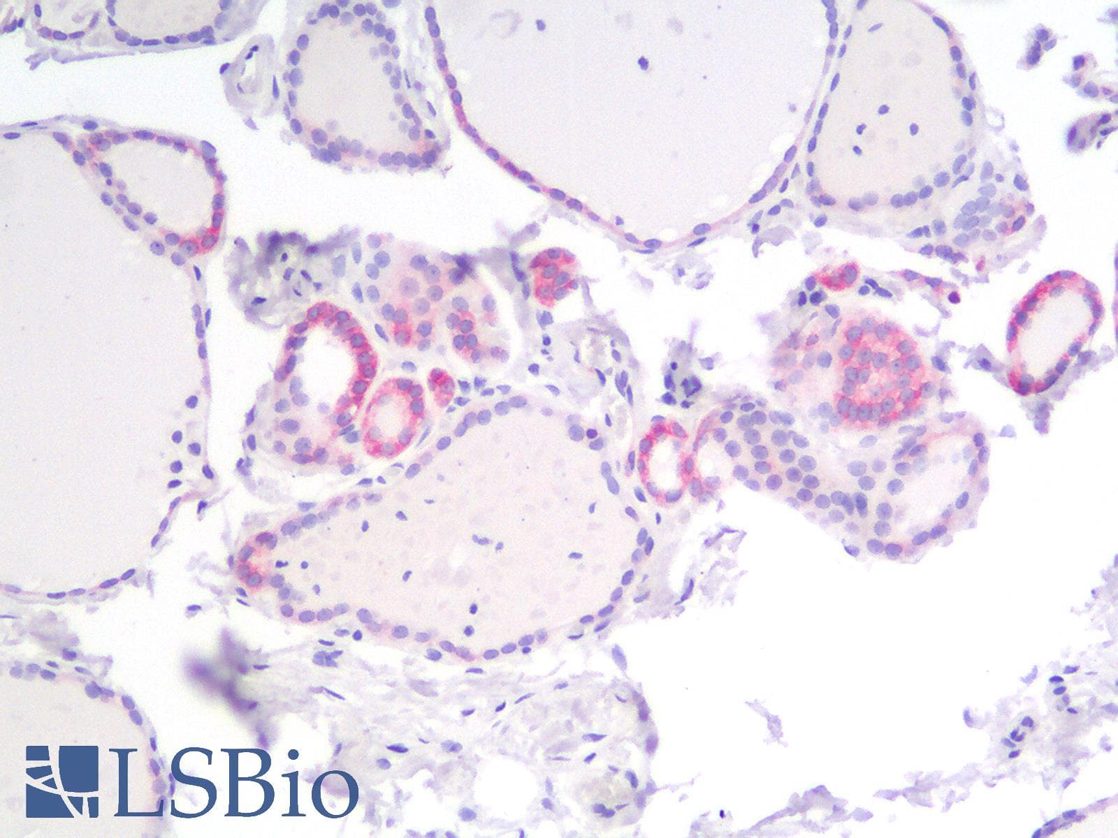 PathPlus™ BCL2 / Bcl-2 Antibody (clone rBCL2/782)