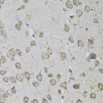 TRPC3 Antibody