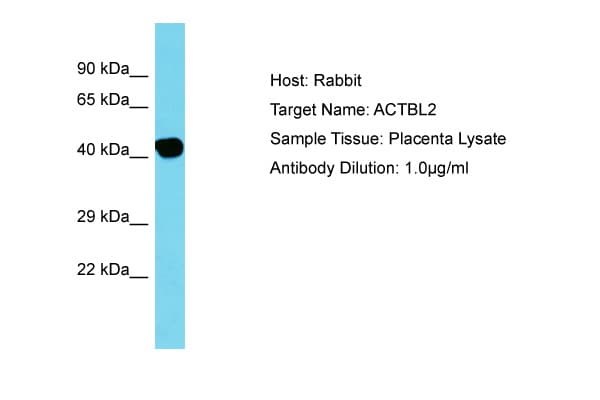 ACTBL2 Antibody (C-Terminus)