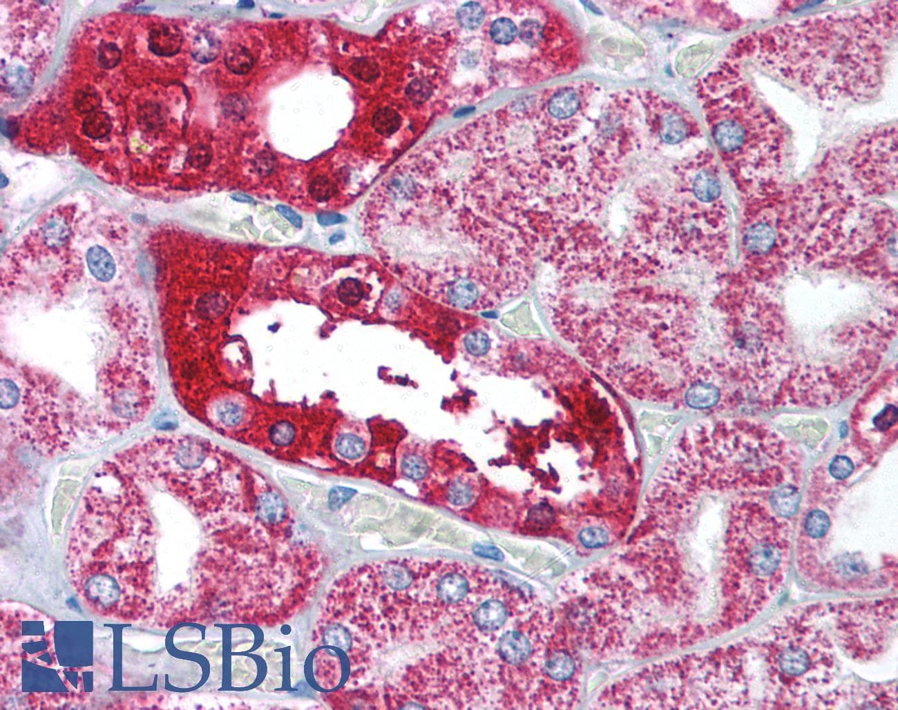 Polyclonal Rabbit anti-Human NPHS1 / Nephrin Antibody (IHC, IF, WB)