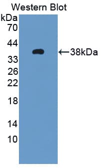MAOB / Monoamine Oxidase B Antibody (aa206-505, Biotin)