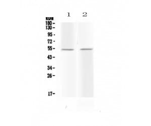 PROC / Protein C Antibody