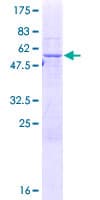 Human SCO2 Protein (Recombinant GST)