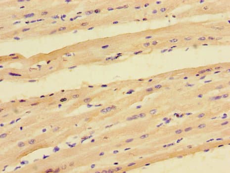 Polyclonal Rabbit anti-Human PPP1R12C / MBS85 Antibody (IHC, IF)