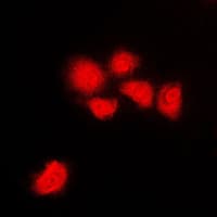 CDC2 + CDK2 + CDK3 Antibody (phospho-Thr14)
