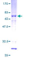 Human HOXC11 Protein (Recombinant GST)