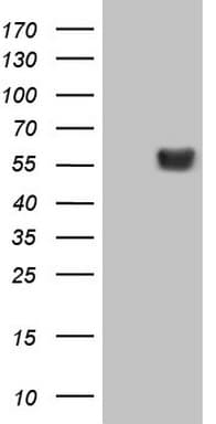 LRRC6 Antibody (clone OTI7E9, Carrier-free)