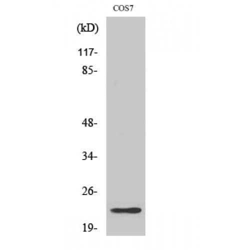 CBLN2 / Cerebellin 2 Antibody (130-210 aa, C-terminal)