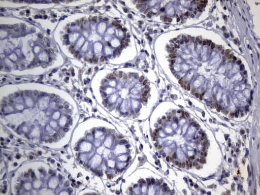MSH2 Antibody (aa1-304, clone UMAB259)