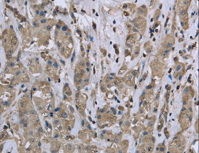 Polyclonal Rabbit anti-Human MRLC2 / MYL12B Antibody (IHC, WB)