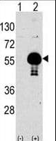 AKT2 Antibody (aa93-123)