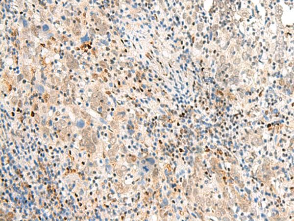 POM121 Antibody