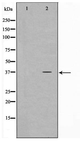 ELOVL4 Antibody