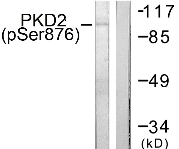 Polyclonal Rabbit anti-Human PRKD2 / PKD2 Antibody (phospho-Ser876, WB)