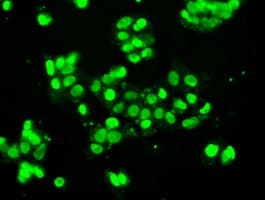 IHC-plus™ SSB / La Antibody (clone 1E11)