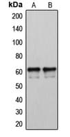 CYP2U1 Antibody (Internal)