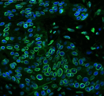 EMD / Emerin Antibody