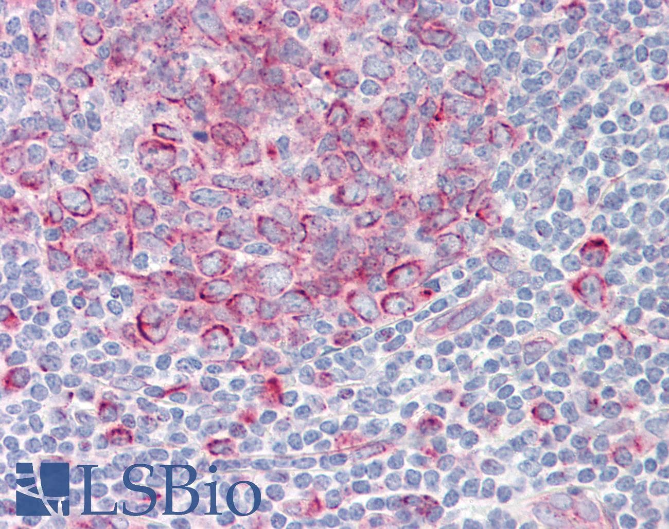 IHC-plus™ TAF1 Antibody (aa1131-1180)