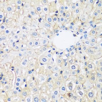 Polyclonal Rabbit anti-Human ARL4A / ARL4 Antibody (IHC, IF)