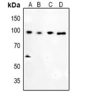 NR3C1/Glucocorticoid Receptor Antibody