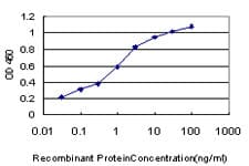 TAOK1 / TAO1 Antibody (clone 4E12)