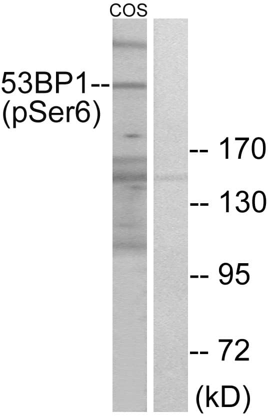 TP53BP1 / 53BP1 Antibody (phospho-Ser6)