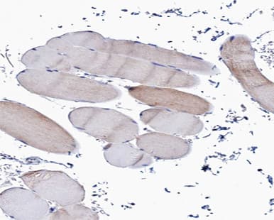 Polyclonal Rabbit anti-Human COL5A1 / Collagen V Alpha 1 Antibody (IHC, IF, WB)