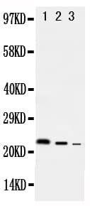 Polyclonal Rabbit anti-Rat IL-10 Antibody (aa19-178, IHC, WB)