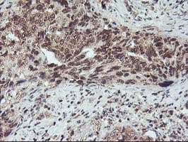FMR1 / FMRP Antibody (clone OTI2C3)