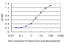 IHC-plus™ SGK1 / SGK Antibody (clone 3C4)