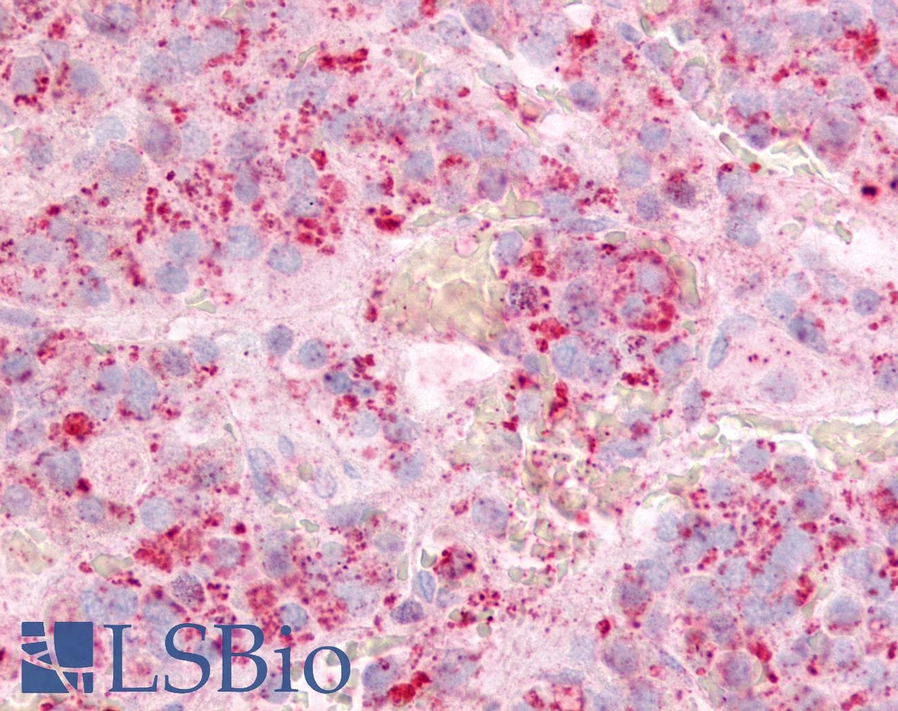 PathPlus™ GPR12 Antibody (Extracellular Domain)