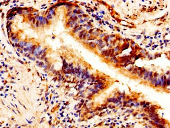 PTN / Pleiotrophin Antibody